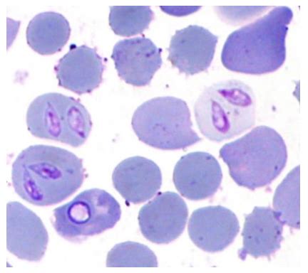 Babesia! A Tiny Parasite With a Big Impact on Mammalian Health