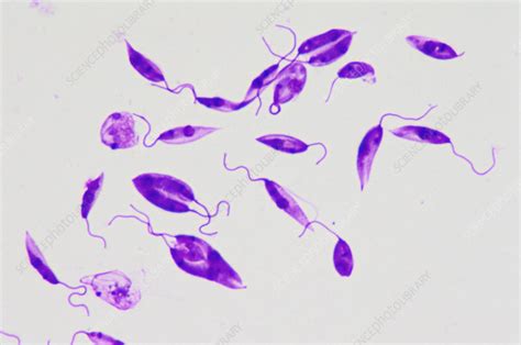 Leishmania Donovani! A Tiny Parasite That Thrives In Dark And Dusty Corners Of The Human Body