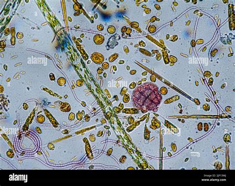  Leptomonas! An Intriguing Glimpse into the World of Microscopic Flagellates with Unpredictable Movements