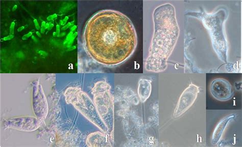  Opercularia! A Curious Amoeboid Master of Shell Construction