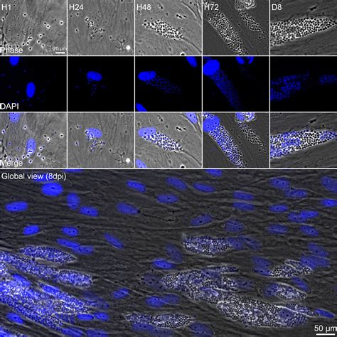  Xenosporium!  This Tiny Parasite Packs a Powerful Punch When It Comes to Hijacking Its Host's Cellular Machinery